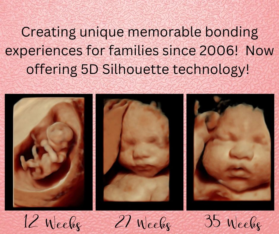 35-weeks-fetus-ultrasound